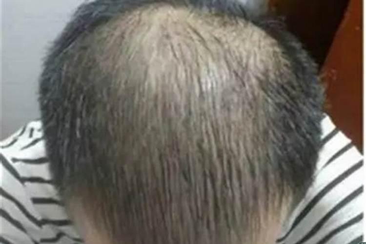 头发多命好还是命苦?