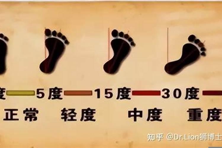 女的走路外八字是不是