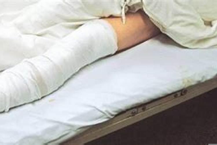 梦见婆婆把腿摔了怎么回事儿