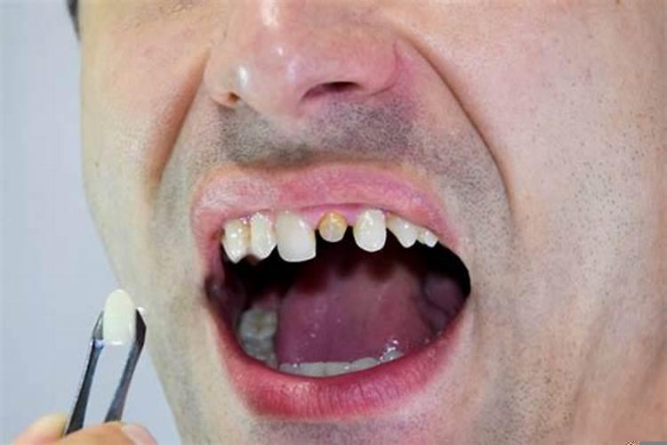 梦见我的牙齿全部掉光了