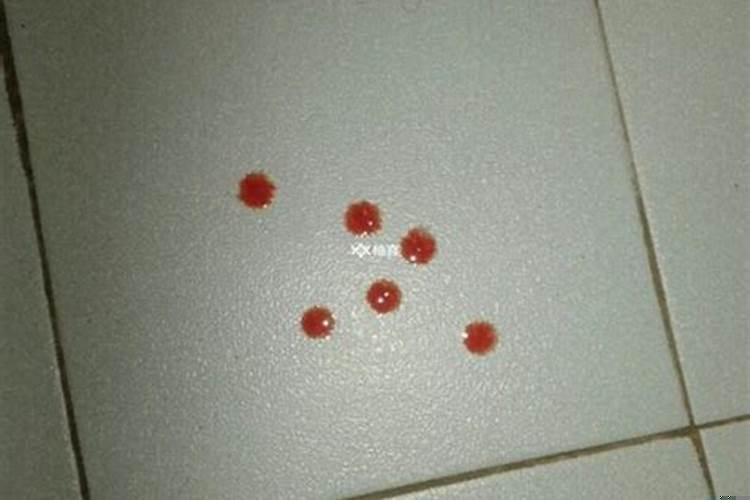 做梦梦到出血是什么兆头