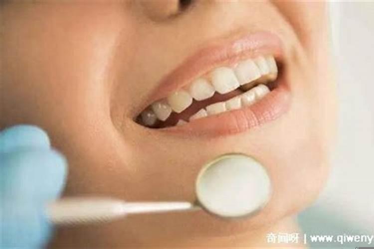 做梦牙掉一大把是啥意思