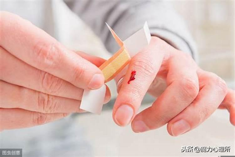 梦见老公身上是血