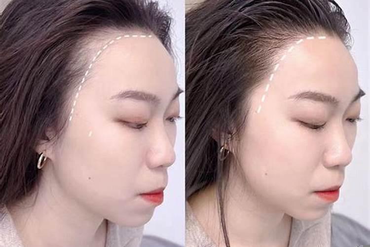 脸色发黑风水怎么讲