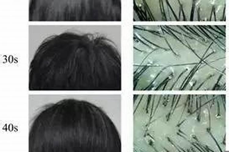 头发寿命到了会怎样