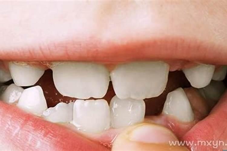 梦到掉牙齿是什么预兆学生