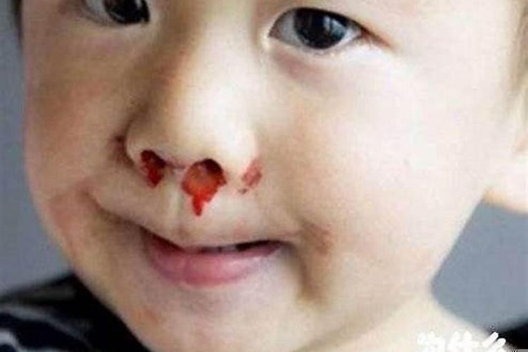 梦见流鼻血但又止住了什么意思