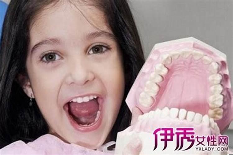 梦见自己牙齿掉了寓意什么