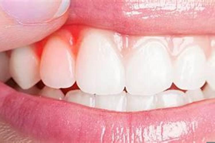 怀孕梦到牙齿松动是什么预兆