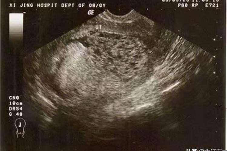 梦见怀孕快生了流血是怎么回事啊