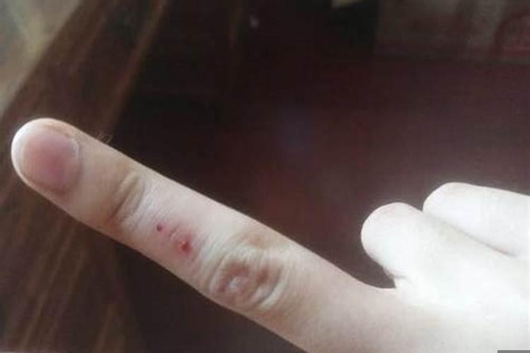 梦见左手受伤流血肉裂