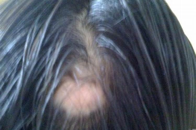 梦见好几个发小什么意思