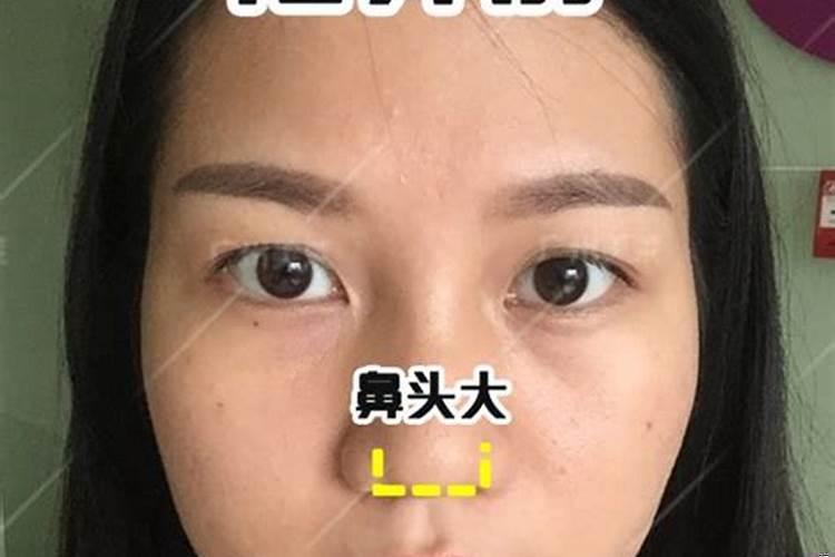 女孩子鼻骨凸起来