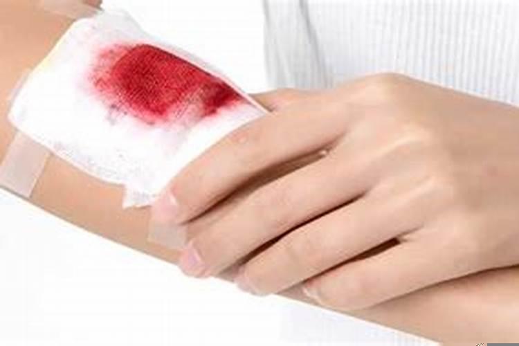 梦见别人受伤流血是什么预兆