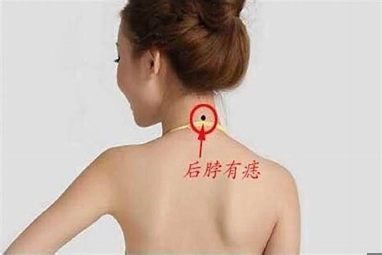 脖子两侧各有一颗痣是什么意思