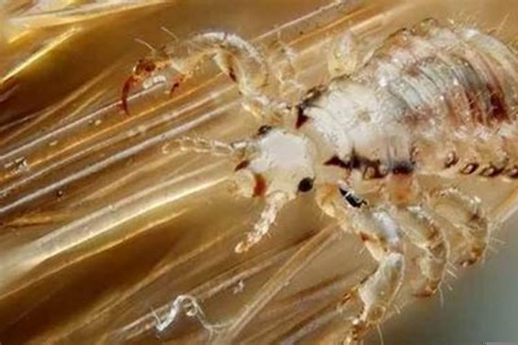 梦见孩子头上长虱子是什么意思