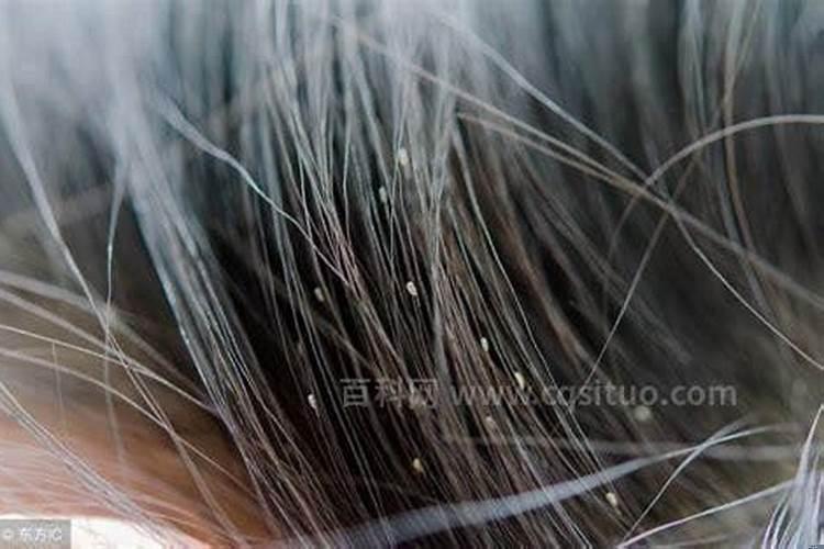 梦见自己的小孩头上长虱子是什么意思