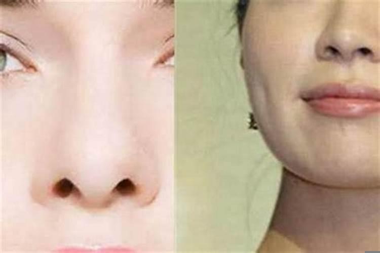 鼻孔漏出来就是漏财吗