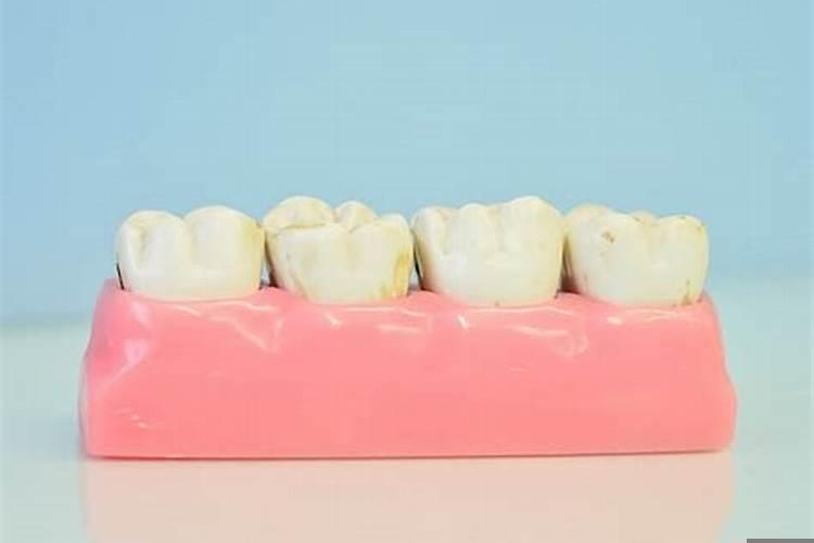 男的梦见掉牙齿是什么征兆解梦