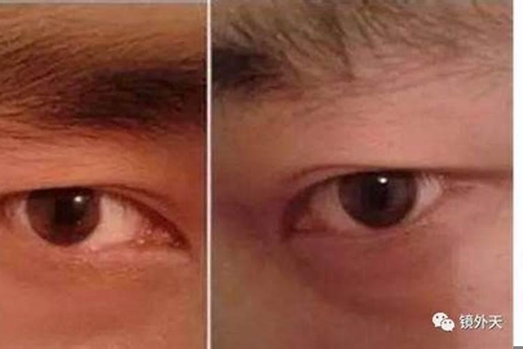 眼睛能看出人的命运吗