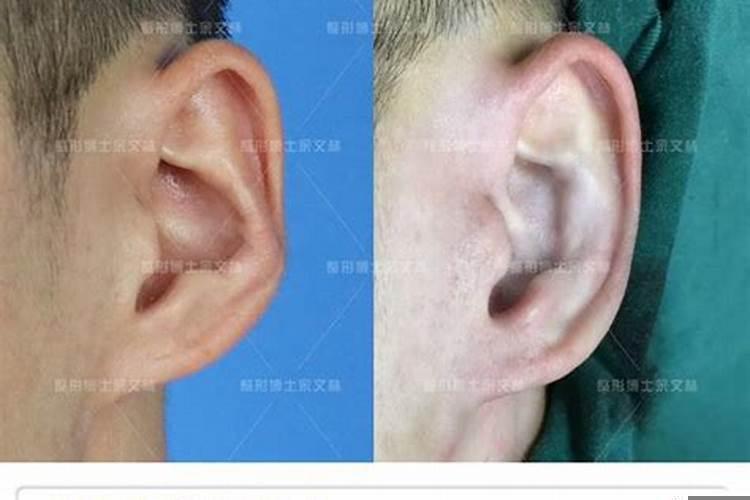 耳反背是什么意思