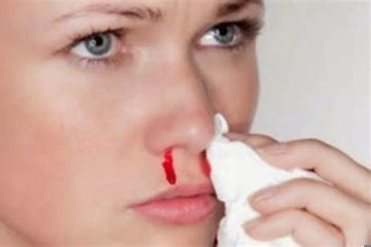 已婚女人梦见自己流鼻血是什么预兆