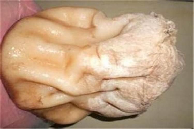 挖出太岁怎么办