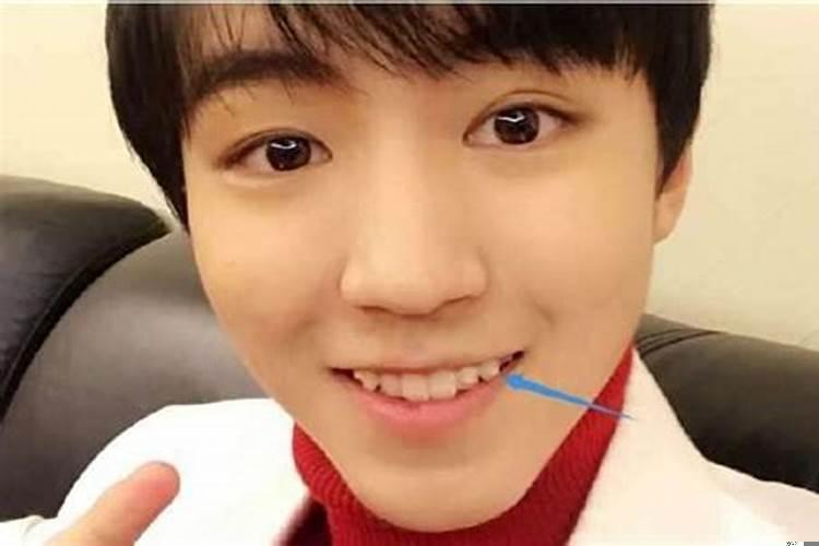 上下有虎牙的人