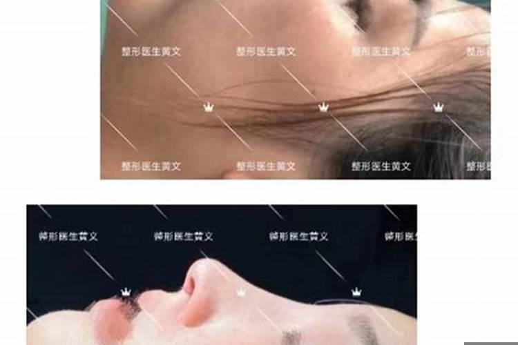 隆鼻会破坏运势吗