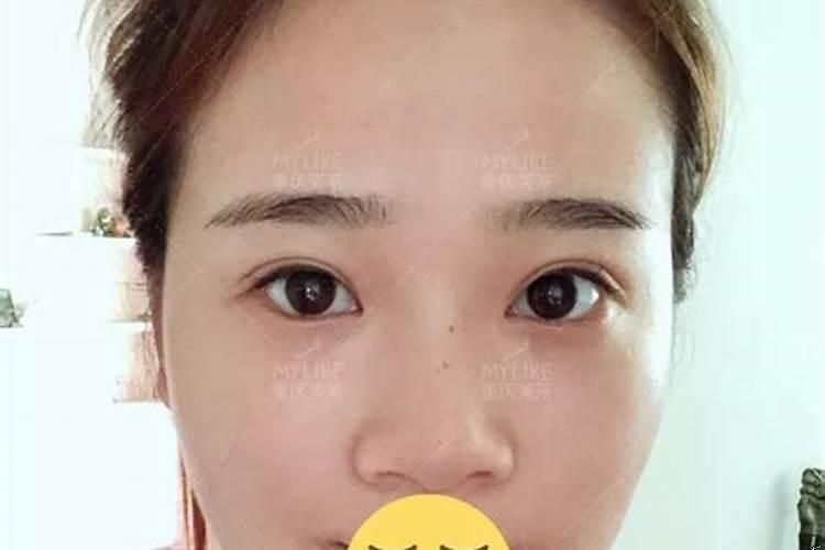 隆鼻会破坏运势吗