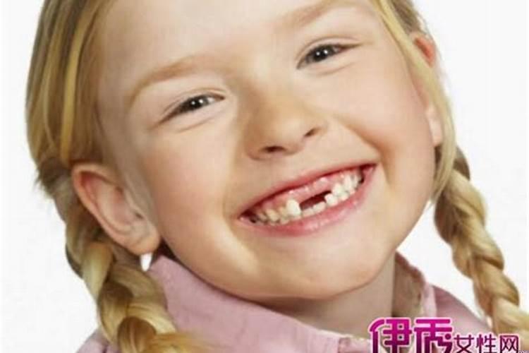 梦见掉牙齿寓意是什么