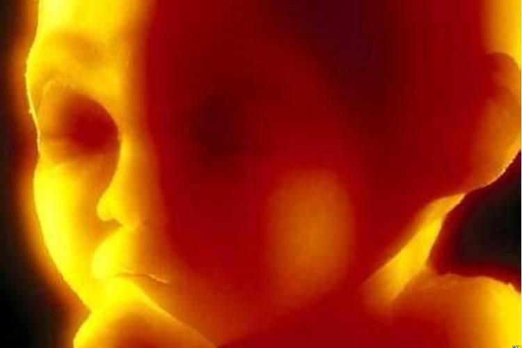 孕早期梦见小狗