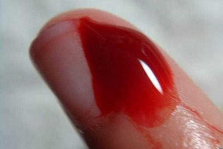 梦见手指受伤流血裂开了（梦见手被划伤流血了什么意思周公解梦）