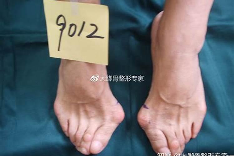 脚大脚粗的女人好不好