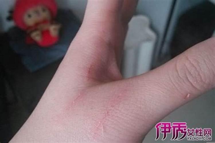 梦见被猫抓伤手出血怎么回事