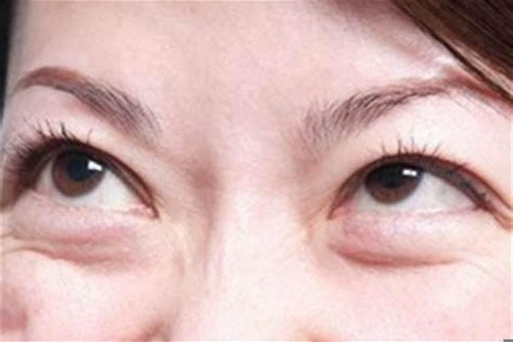 眼袋大的人命运