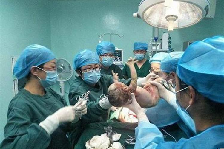 顺产和剖腹产的命理